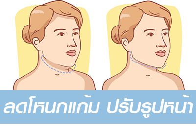 ลดโหนกแก้ม-ปรับรูปหน้า